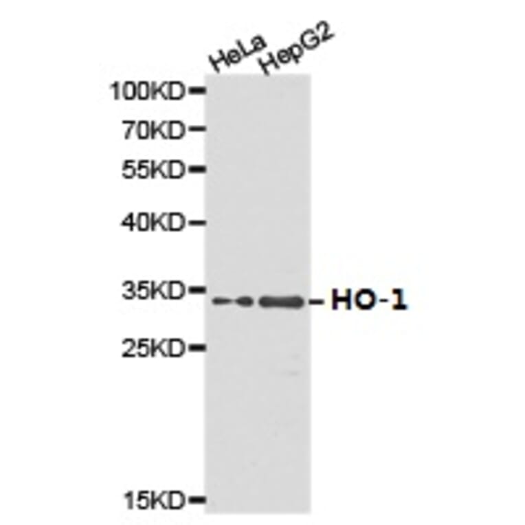 Anti-HO-1 Antibody from Bioworld Technology (BS6626) - Antibodies.com