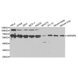 Anti-hnRNP K Antibody from Bioworld Technology (BS6627) - Antibodies.com