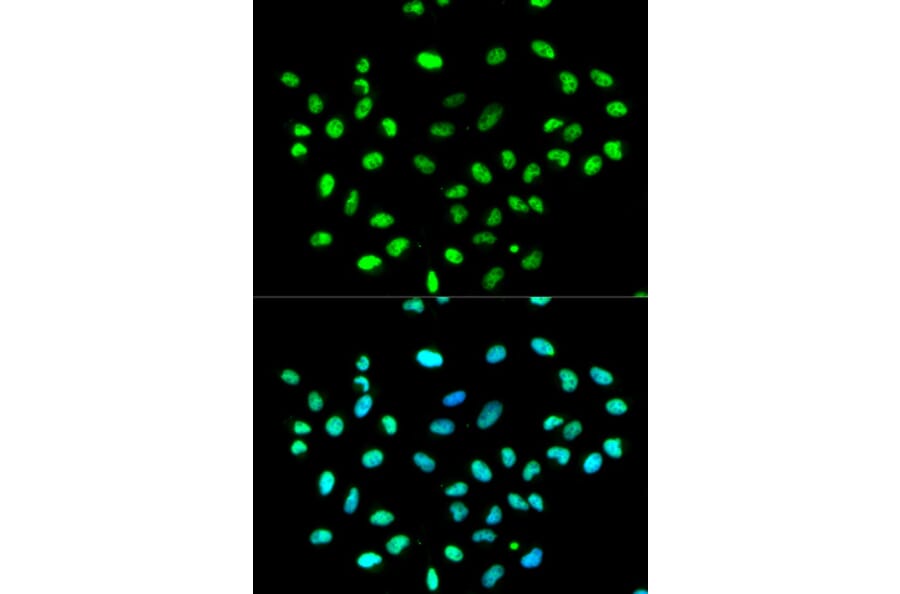 Anti-hnRNP K Antibody from Bioworld Technology (BS6627) - Antibodies.com