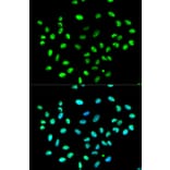Anti-hnRNP K Antibody from Bioworld Technology (BS6627) - Antibodies.com
