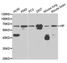 Anti-Haptoglobin / HP Antibody from Bioworld Technology (BS6628) - Antibodies.com