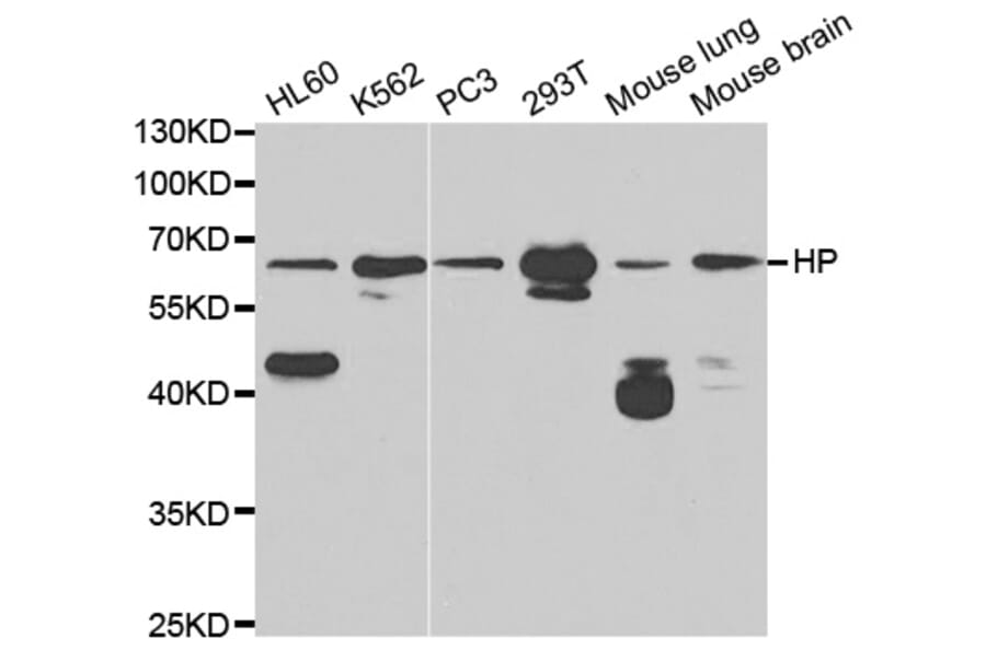 Anti-Haptoglobin / HP Antibody from Bioworld Technology (BS6628) - Antibodies.com