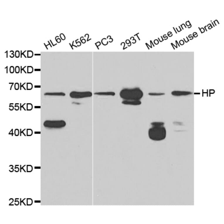 Anti-Haptoglobin / HP Antibody from Bioworld Technology (BS6628) - Antibodies.com