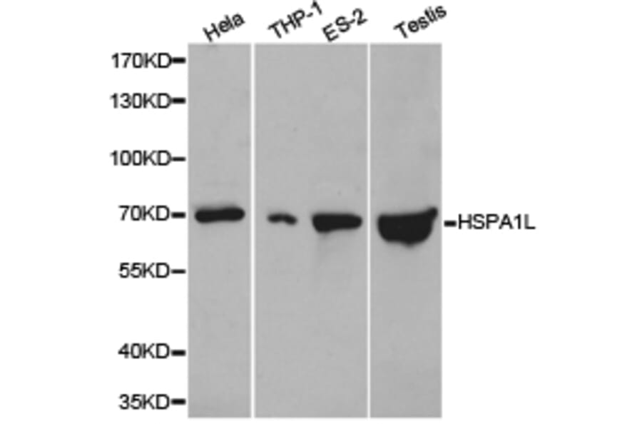 Anti-HSPA1L Antibody from Bioworld Technology (BS6629) - Antibodies.com
