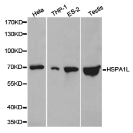 Anti-HSPA1L Antibody from Bioworld Technology (BS6629) - Antibodies.com