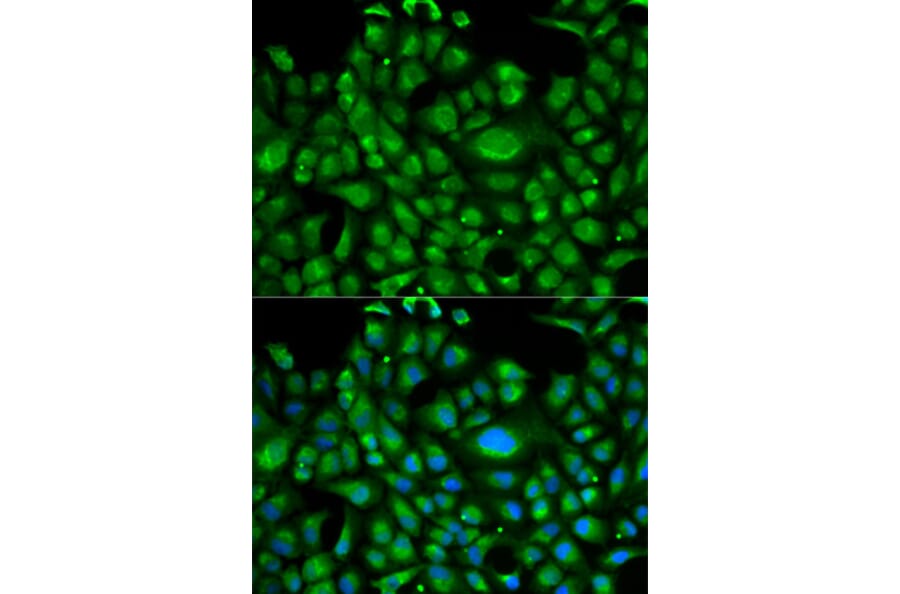 Anti-HSPA1L Antibody from Bioworld Technology (BS6629) - Antibodies.com