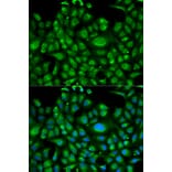 Anti-HSPA1L Antibody from Bioworld Technology (BS6629) - Antibodies.com