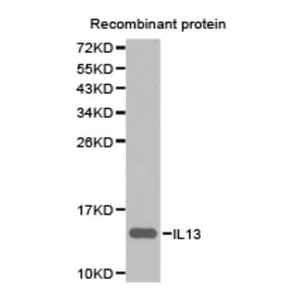 Anti-IL13 Antibody from Bioworld Technology (BS6637) - Antibodies.com