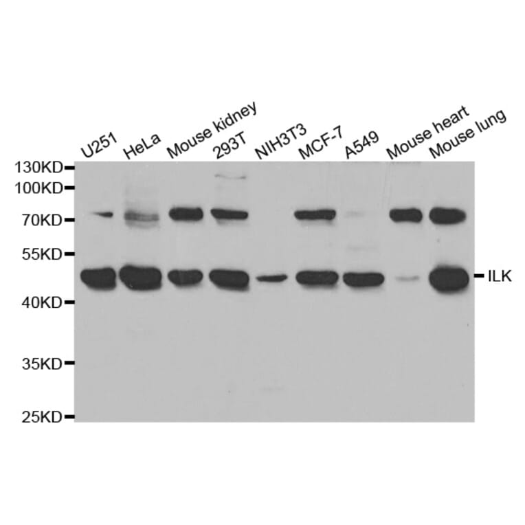 Anti-ILK Antibody from Bioworld Technology (BS6638) - Antibodies.com