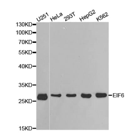 Anti-eIF6 Antibody from Bioworld Technology (BS6641) - Antibodies.com