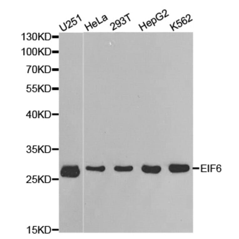 Anti-eIF6 Antibody from Bioworld Technology (BS6641) - Antibodies.com