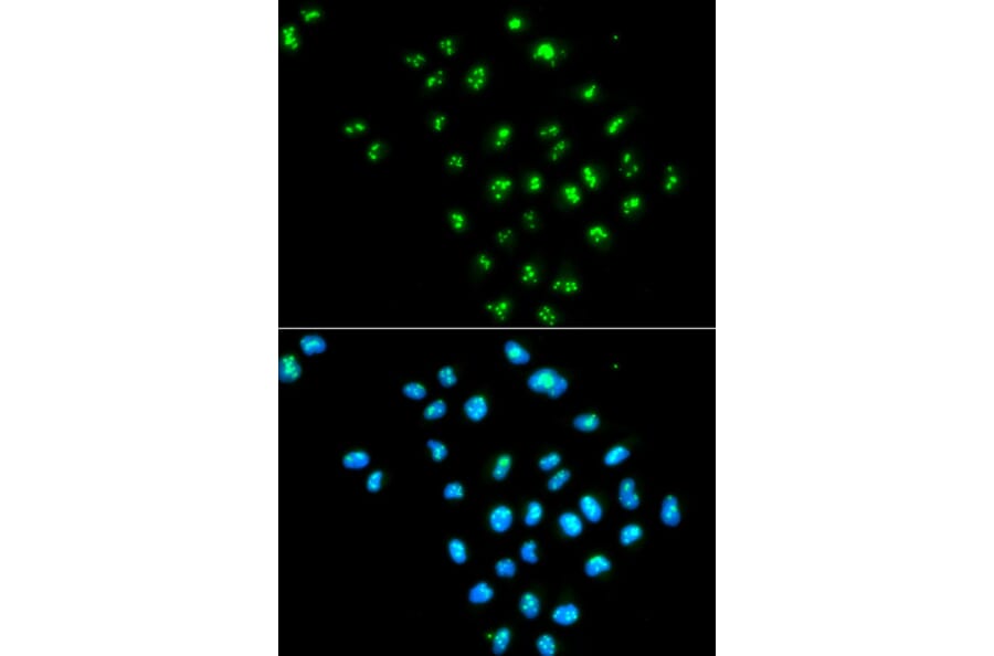 Anti-eIF6 Antibody from Bioworld Technology (BS6641) - Antibodies.com