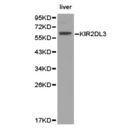 Anti-KIR2DL3 Antibody from Bioworld Technology (BS6643) - Antibodies.com