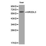Anti-KIR2DL3 Antibody from Bioworld Technology (BS6643) - Antibodies.com