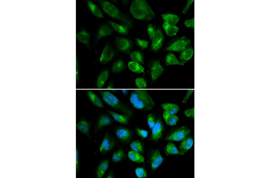 Anti-KIR2DL3 Antibody from Bioworld Technology (BS6643) - Antibodies.com
