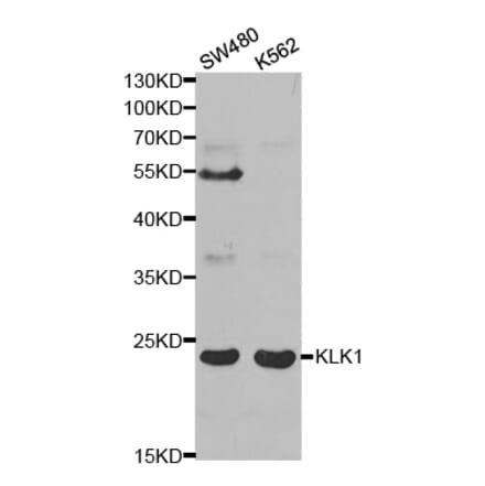 Anti-KLK1 Antibody from Bioworld Technology (BS6644) - Antibodies.com