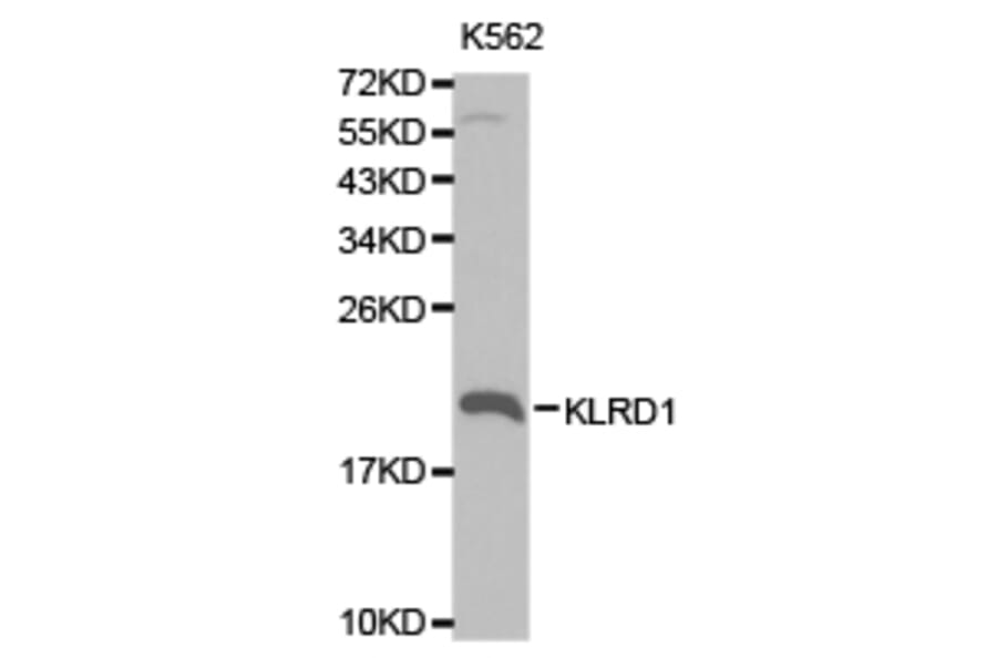 Anti-KLRD1 Antibody from Bioworld Technology (BS6645) - Antibodies.com
