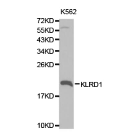 Anti-KLRD1 Antibody from Bioworld Technology (BS6645) - Antibodies.com