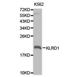 Anti-KLRD1 Antibody from Bioworld Technology (BS6645) - Antibodies.com