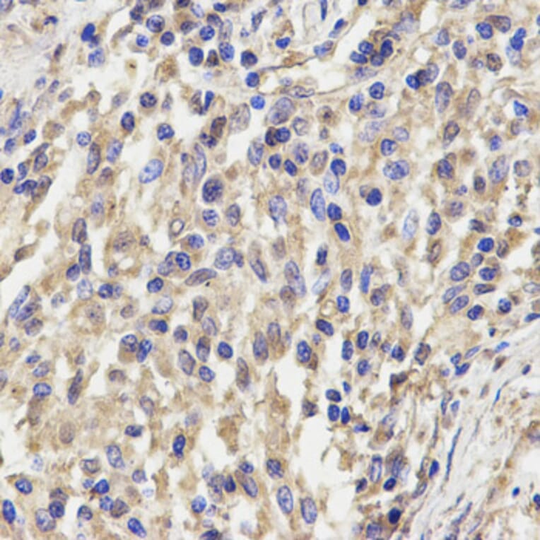 Anti-KLRD1 Antibody from Bioworld Technology (BS6645) - Antibodies.com