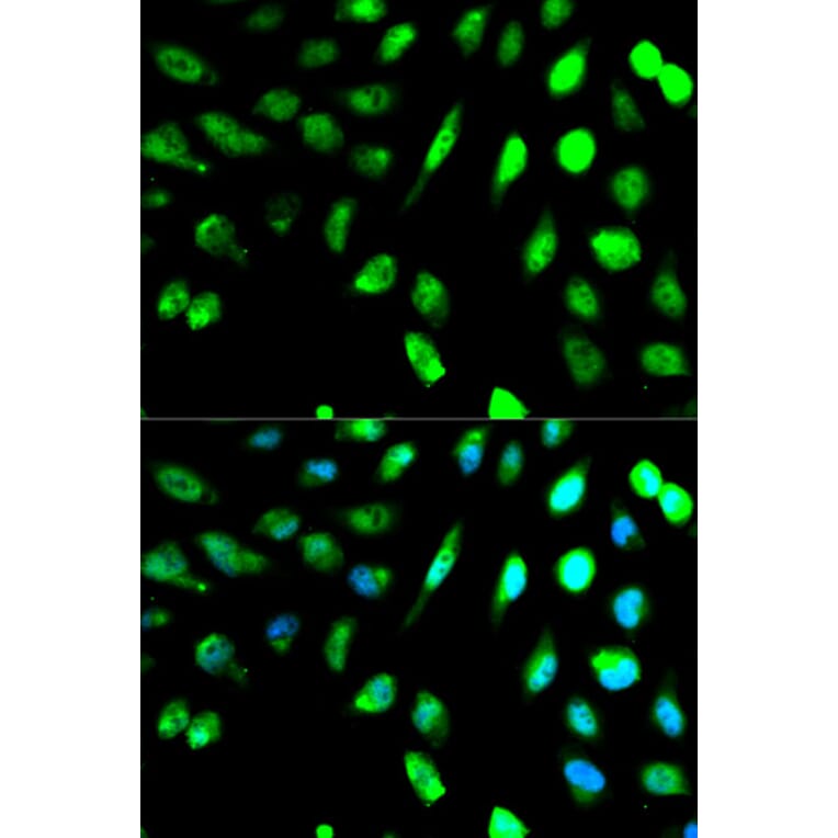Anti-KLRD1 Antibody from Bioworld Technology (BS6645) - Antibodies.com