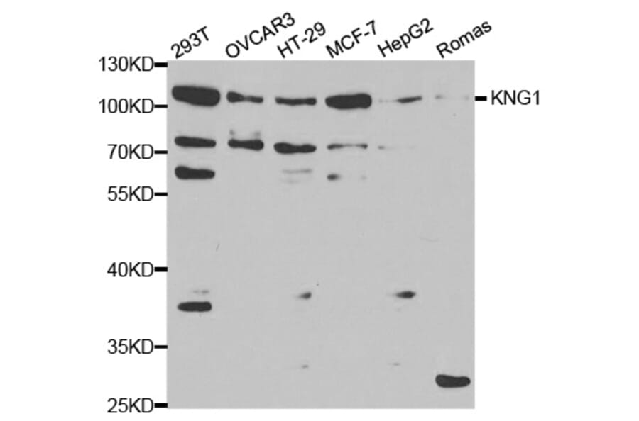 Anti-KNG1 Antibody from Bioworld Technology (BS6646) - Antibodies.com