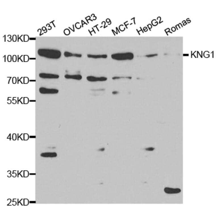 Anti-KNG1 Antibody from Bioworld Technology (BS6646) - Antibodies.com