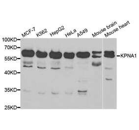 Anti-KPNA1 Antibody from Bioworld Technology (BS6647) - Antibodies.com