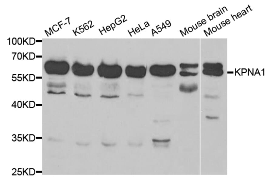 Anti-KPNA1 Antibody from Bioworld Technology (BS6647) - Antibodies.com