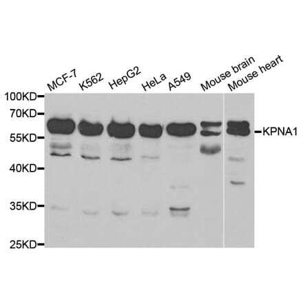 Anti-KPNA1 Antibody from Bioworld Technology (BS6647) - Antibodies.com