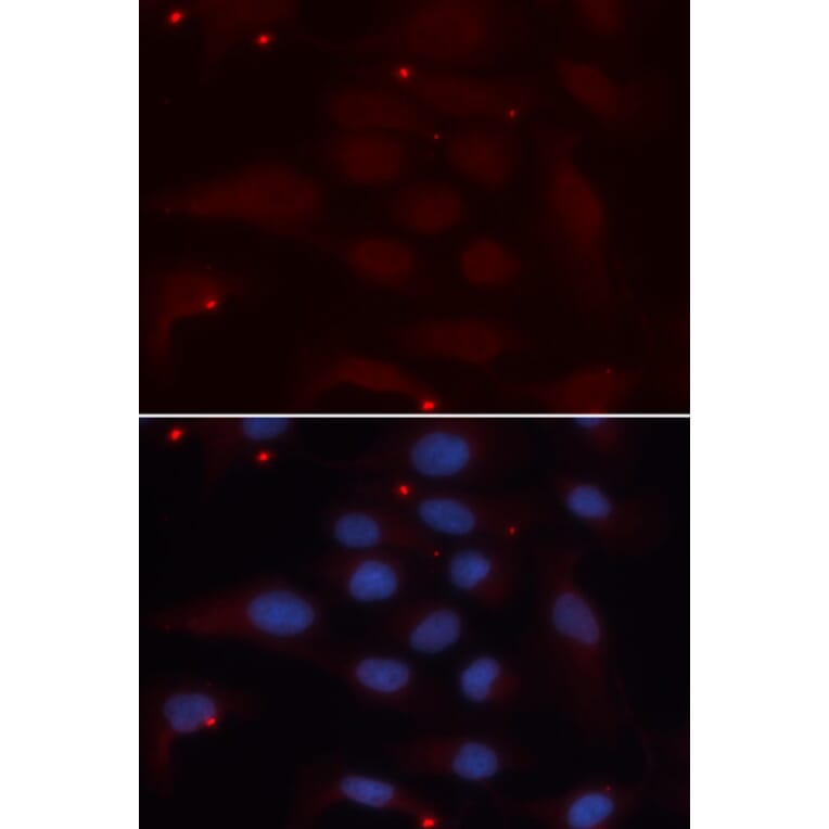 Anti-KPNA1 Antibody from Bioworld Technology (BS6647) - Antibodies.com
