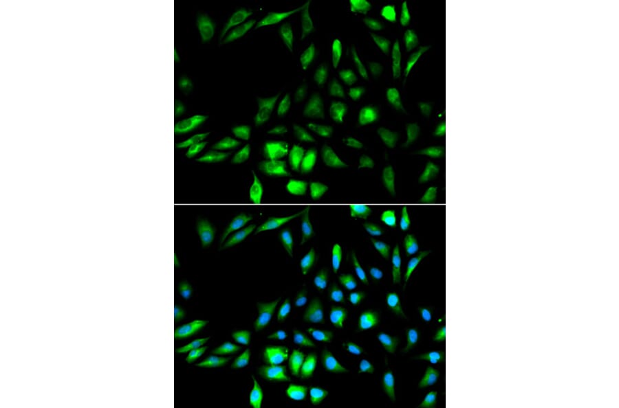 Anti-KPNA2 Antibody from Bioworld Technology (BS6648) - Antibodies.com