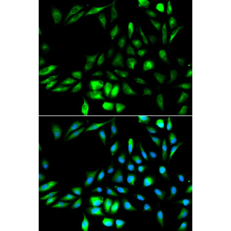 Anti-KPNA2 Antibody from Bioworld Technology (BS6648) - Antibodies.com
