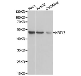 Anti-Cytokeratin 17 Antibody from Bioworld Technology (BS6649) - Antibodies.com