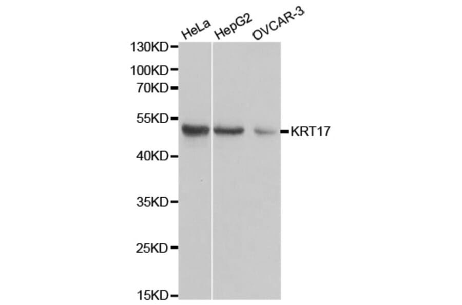 Anti-Cytokeratin 17 Antibody from Bioworld Technology (BS6649) - Antibodies.com
