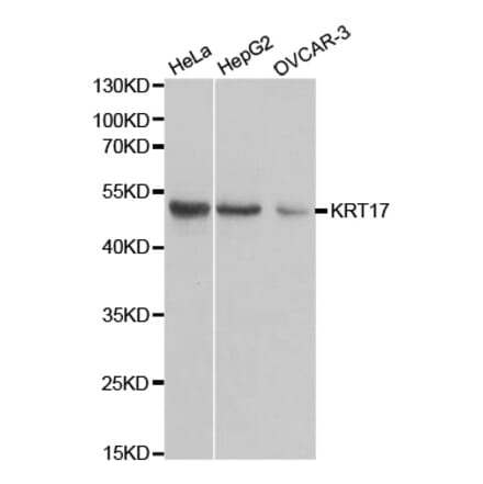 Anti-Cytokeratin 17 Antibody from Bioworld Technology (BS6649) - Antibodies.com