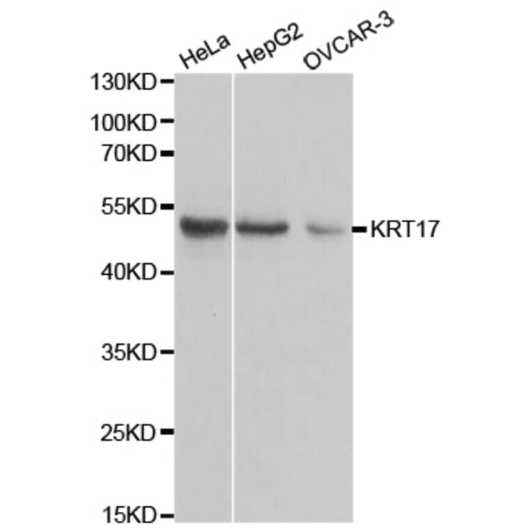 Anti-Cytokeratin 17 Antibody from Bioworld Technology (BS6649) - Antibodies.com