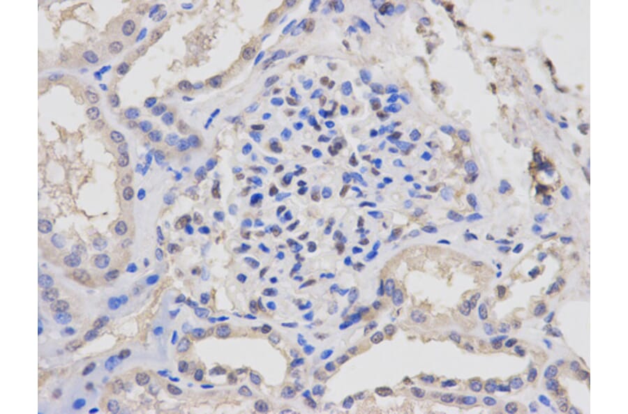 Anti-Lck Antibody from Bioworld Technology (BS6650) - Antibodies.com