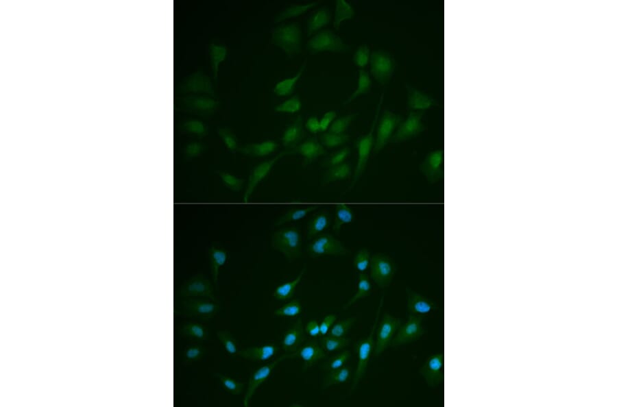 Anti-DNA Ligase I Antibody from Bioworld Technology (BS6652) - Antibodies.com