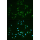 Anti-DNA Ligase I Antibody from Bioworld Technology (BS6652) - Antibodies.com