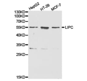 Anti-LIPC Antibody from Bioworld Technology (BS6655) - Antibodies.com