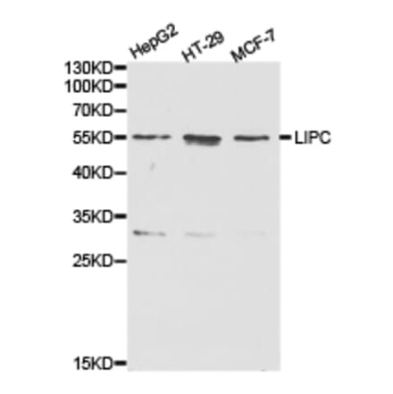 Anti-LIPC Antibody from Bioworld Technology (BS6655) - Antibodies.com