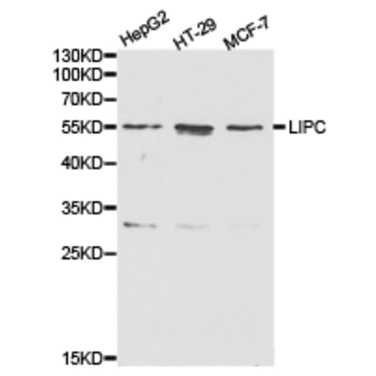 Anti-LIPC Antibody from Bioworld Technology (BS6655) - Antibodies.com