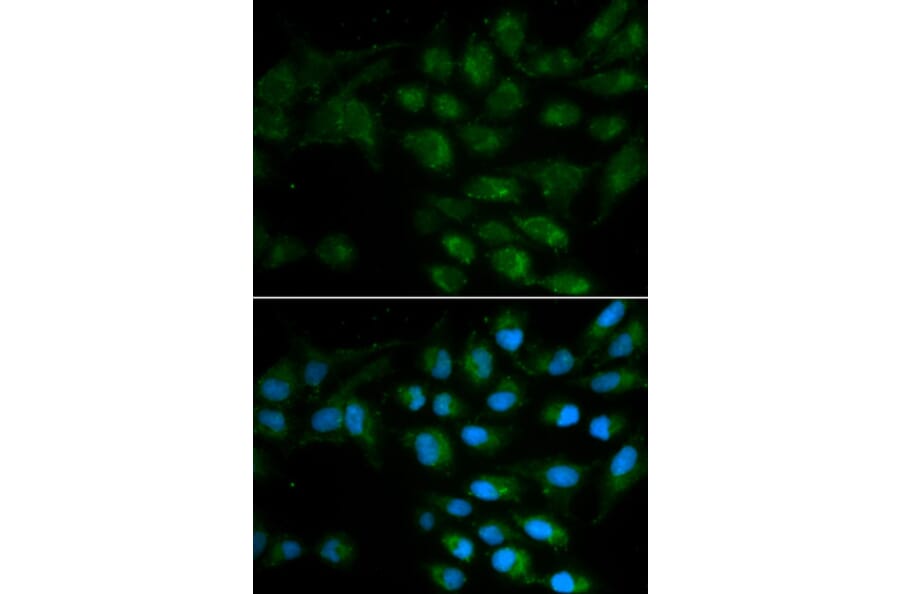Anti-LIPC Antibody from Bioworld Technology (BS6655) - Antibodies.com