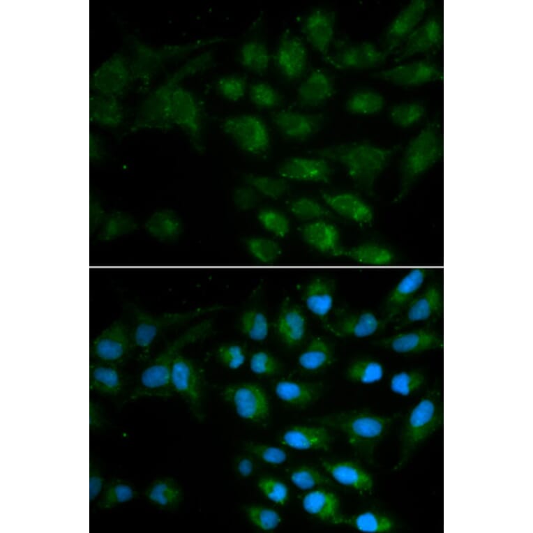 Anti-LIPC Antibody from Bioworld Technology (BS6655) - Antibodies.com