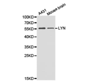 Anti-Lyn Antibody from Bioworld Technology (BS6657) - Antibodies.com