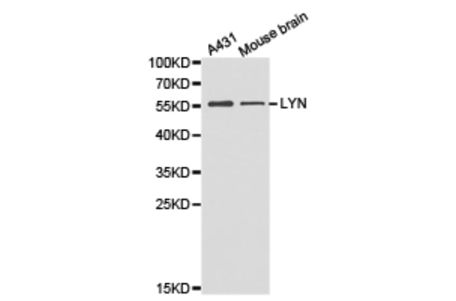 Anti-Lyn Antibody from Bioworld Technology (BS6657) - Antibodies.com
