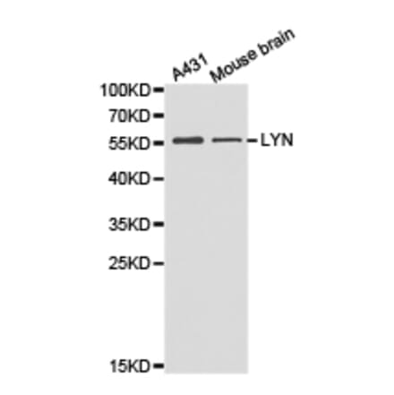 Anti-Lyn Antibody from Bioworld Technology (BS6657) - Antibodies.com