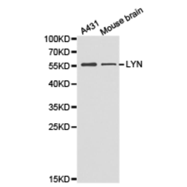 Anti-Lyn Antibody from Bioworld Technology (BS6657) - Antibodies.com