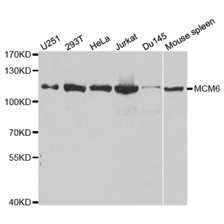 Anti-MCM6 Antibody from Bioworld Technology (BS6661) - Antibodies.com